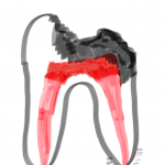 神経の炎症イラスト